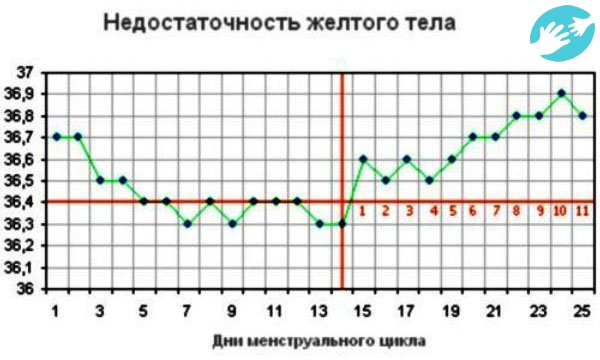 Базальная температура после овуляции ниже 37°C чаще всего указывает на проблемы с овуляцией, а именно, на недостаточность желтого тела