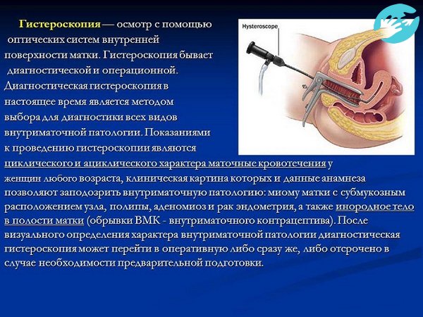 Гистероскопия - проводиться для того, чтобы внимательно рассмотреть рубец, чтобы ответить на главный вопрос, через, сколько можно забеременеть после кесарева сечения