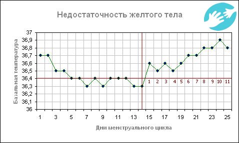 Если температура остается завышенной более 14-ти дней можно говорить о недостаточности желтого тела