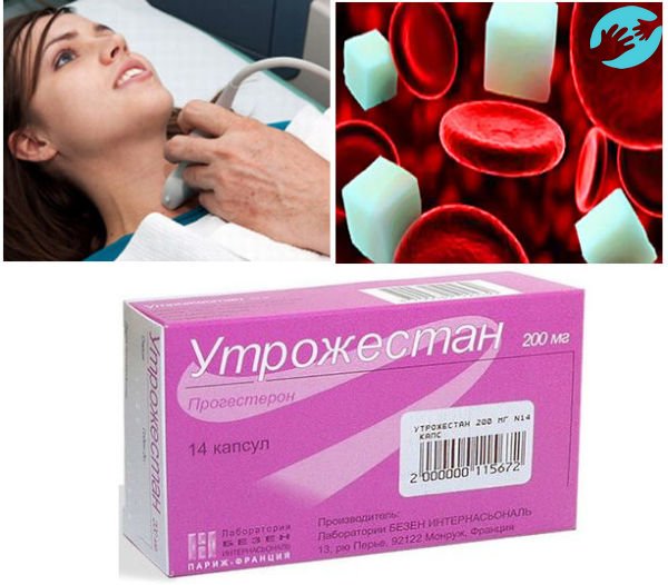 Низкая базальная температура во второй фазе цикла может указывать на замершую беременность, то есть развития плода остановлено может быть по нескольким причинам: гинекологические заболевания, сахарный диабет, болезни щитовидной железы или низкий уровень прогестерона.