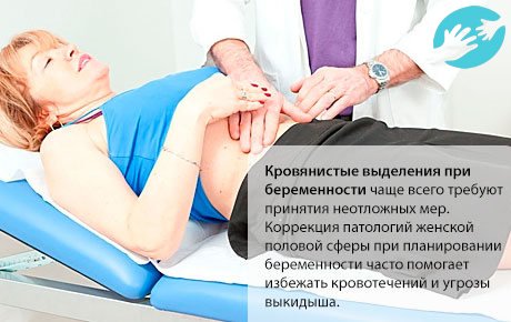При подозрении на угрозу выкидыша температура будет ниже 36,9°C на графике базальной температуры при беременности до задержки.