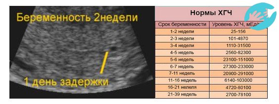 При задержке месячных на 4 дня и продолжительной боли в сосках необходимо сделать УЗИ диагностику и сдать анализ крови на уровень ХГЧ